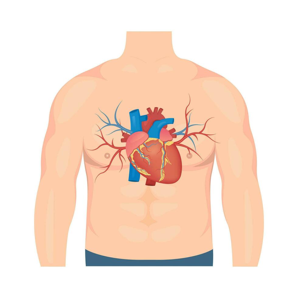 aterosclerosi concetto. umano cuore. medico vettore illustrazione