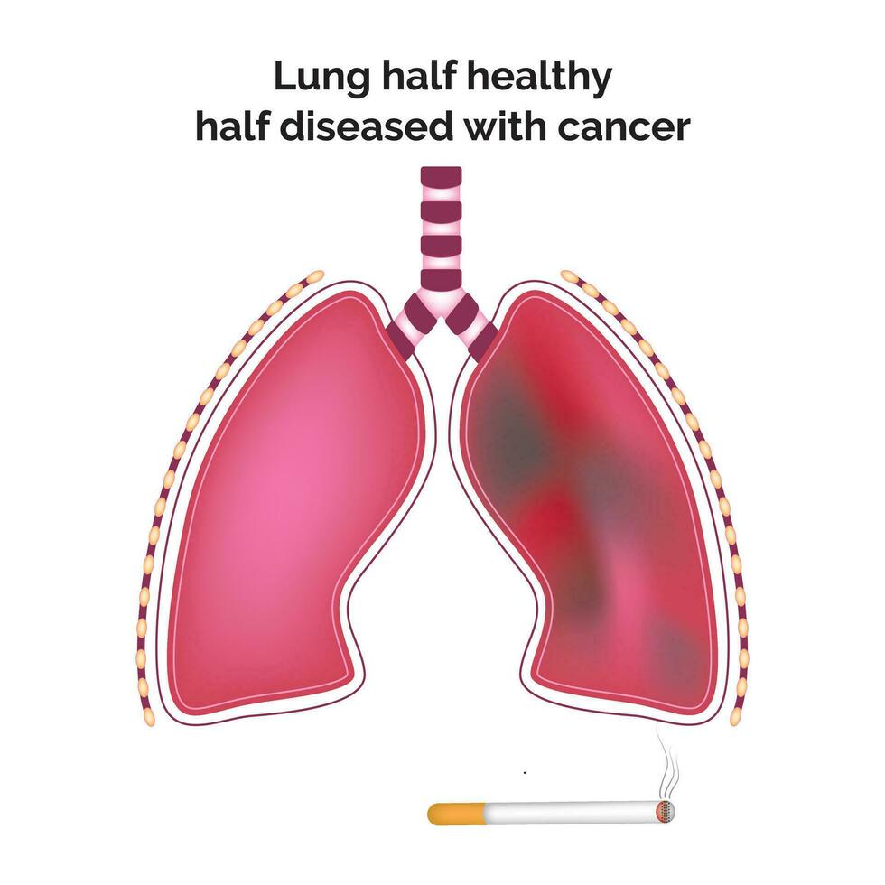 polmone metà salutare metà malato con cancro scienza design vettore illustrazione