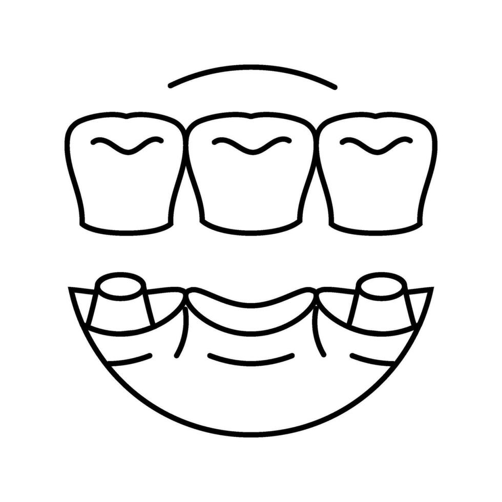 ponte dentale procedura linea icona vettore illustrazione