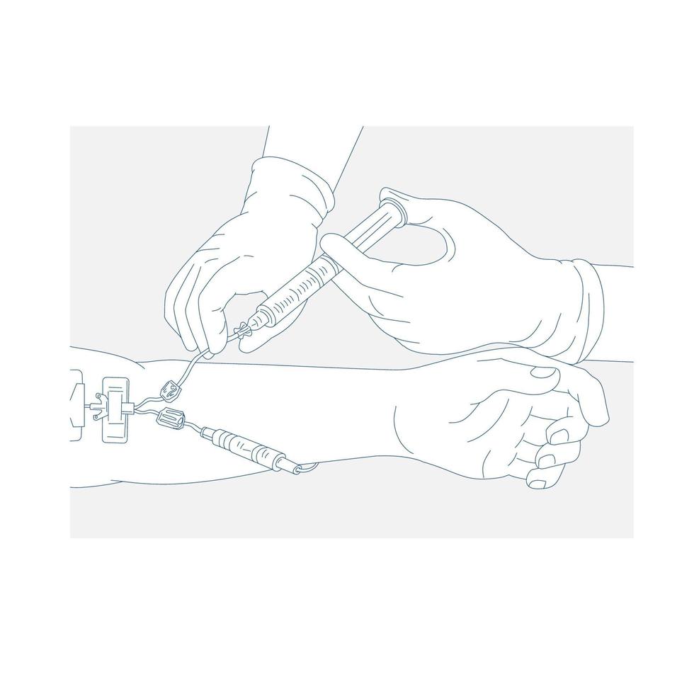 diagramma di terapia infusionale mono linea vettore