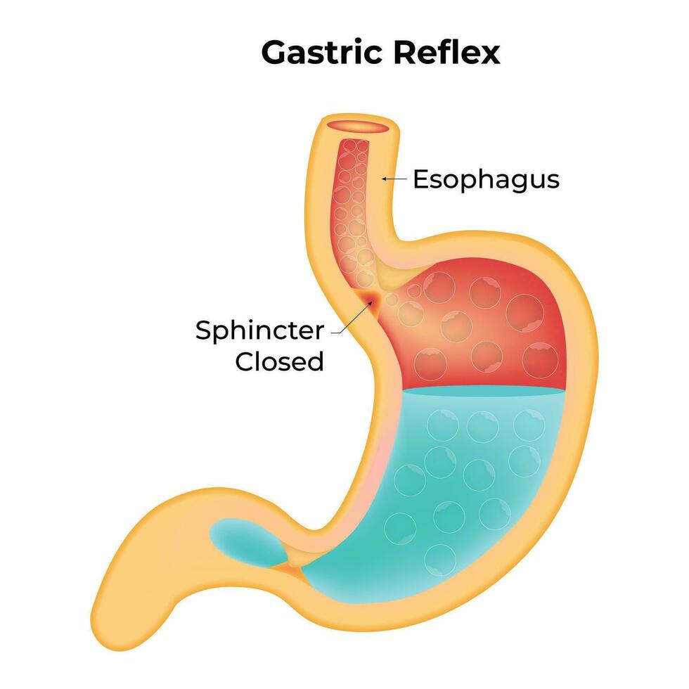 gastrico riflesso scienza design vettore illustrazione