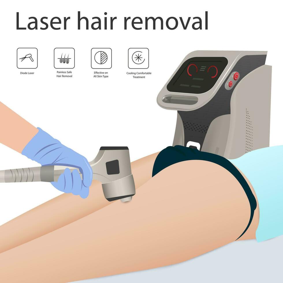 laser capelli rimozione di il pelle strato e follicolo per bellezza e levigatezza di il corpo. capelli rimozione procedura vettore