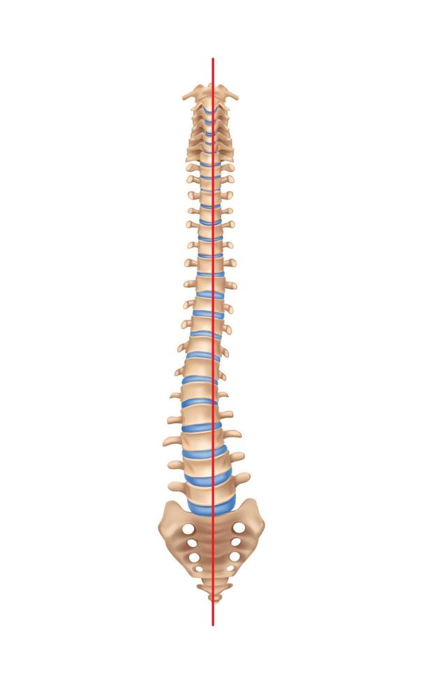 composizione della scoliosi della colonna vertebrale umana vettore