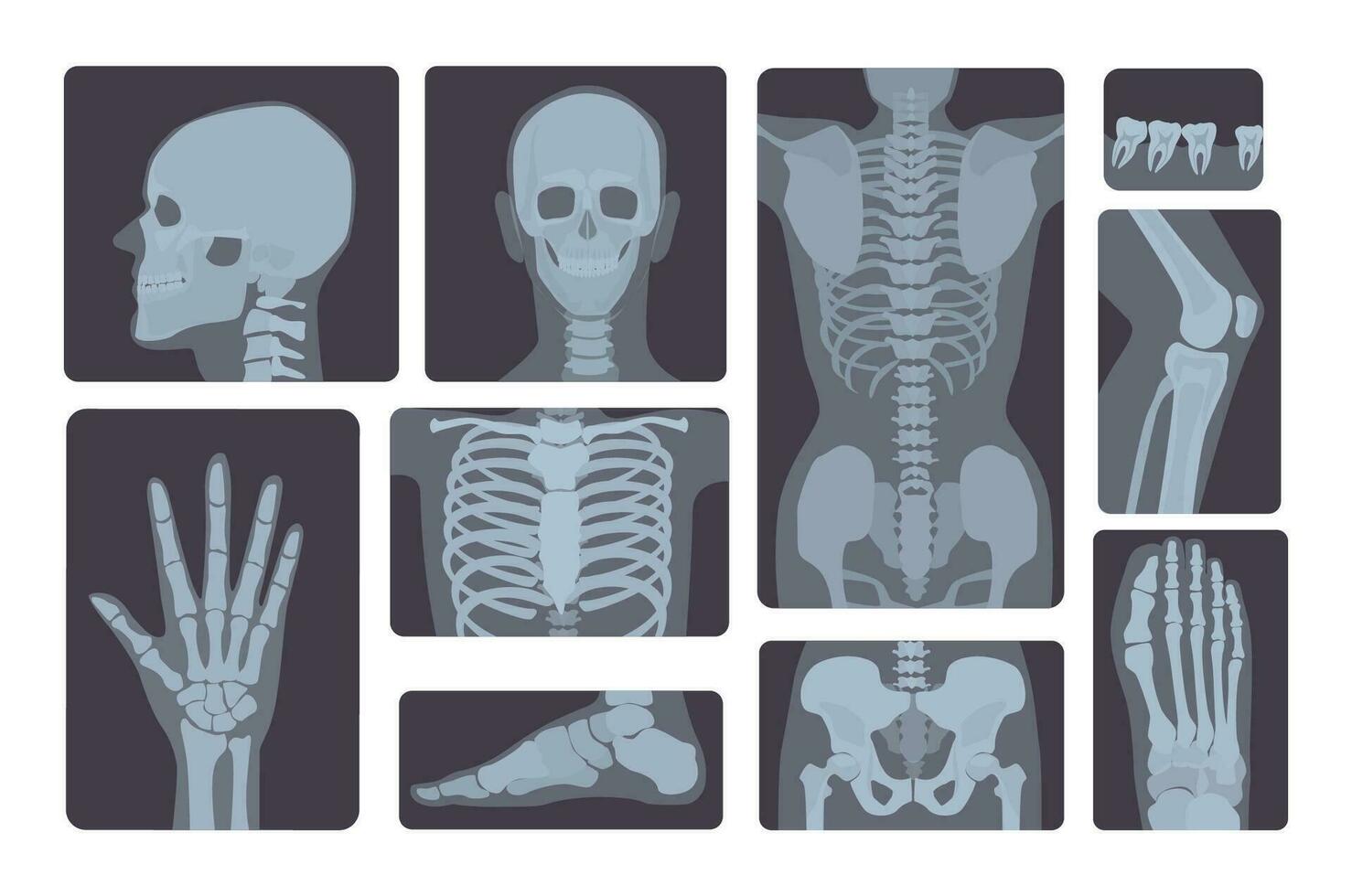 realistico raggi X scatti collezione. umano corpo- mano, gamba, cranio, piede, il petto, denti, colonna vertebrale e Altro. vettore