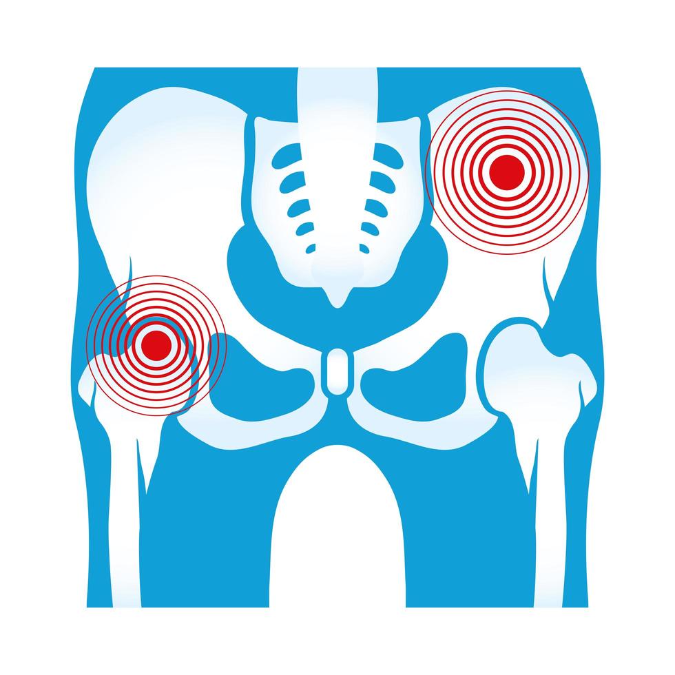 dolori reumatologici fianchi vettore