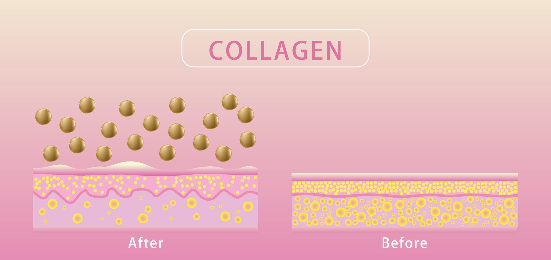 collagene , prima e dopo processi di ottenere pelle, protezione pelle vettore