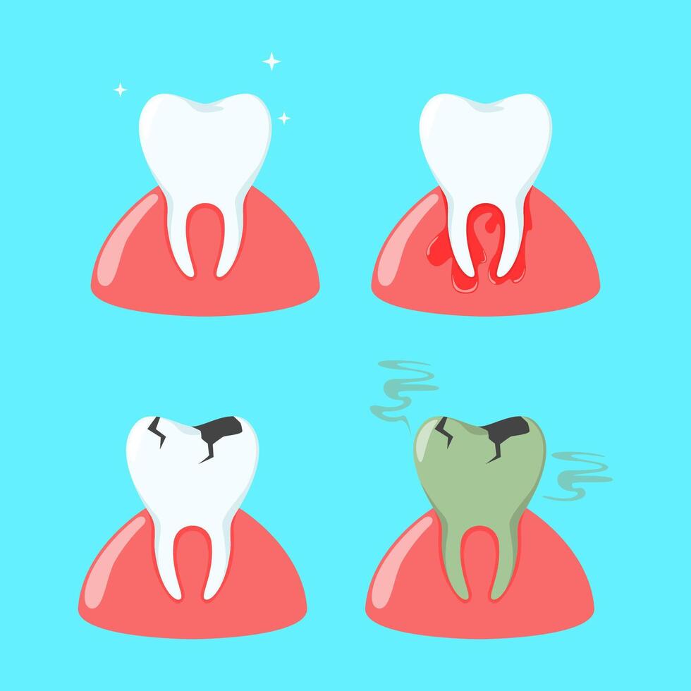 illustrazione design di collezione di denti e mal di denti vettore