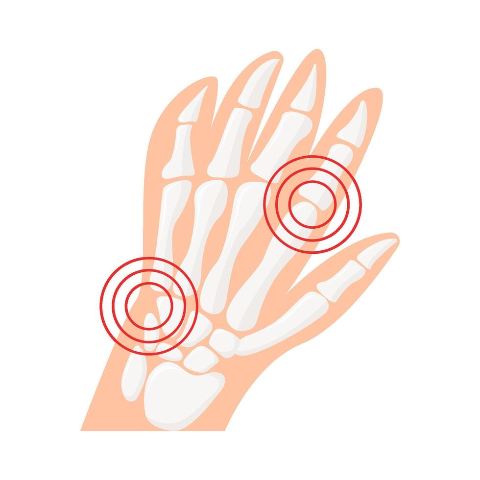 osso mano illustrazione vettore