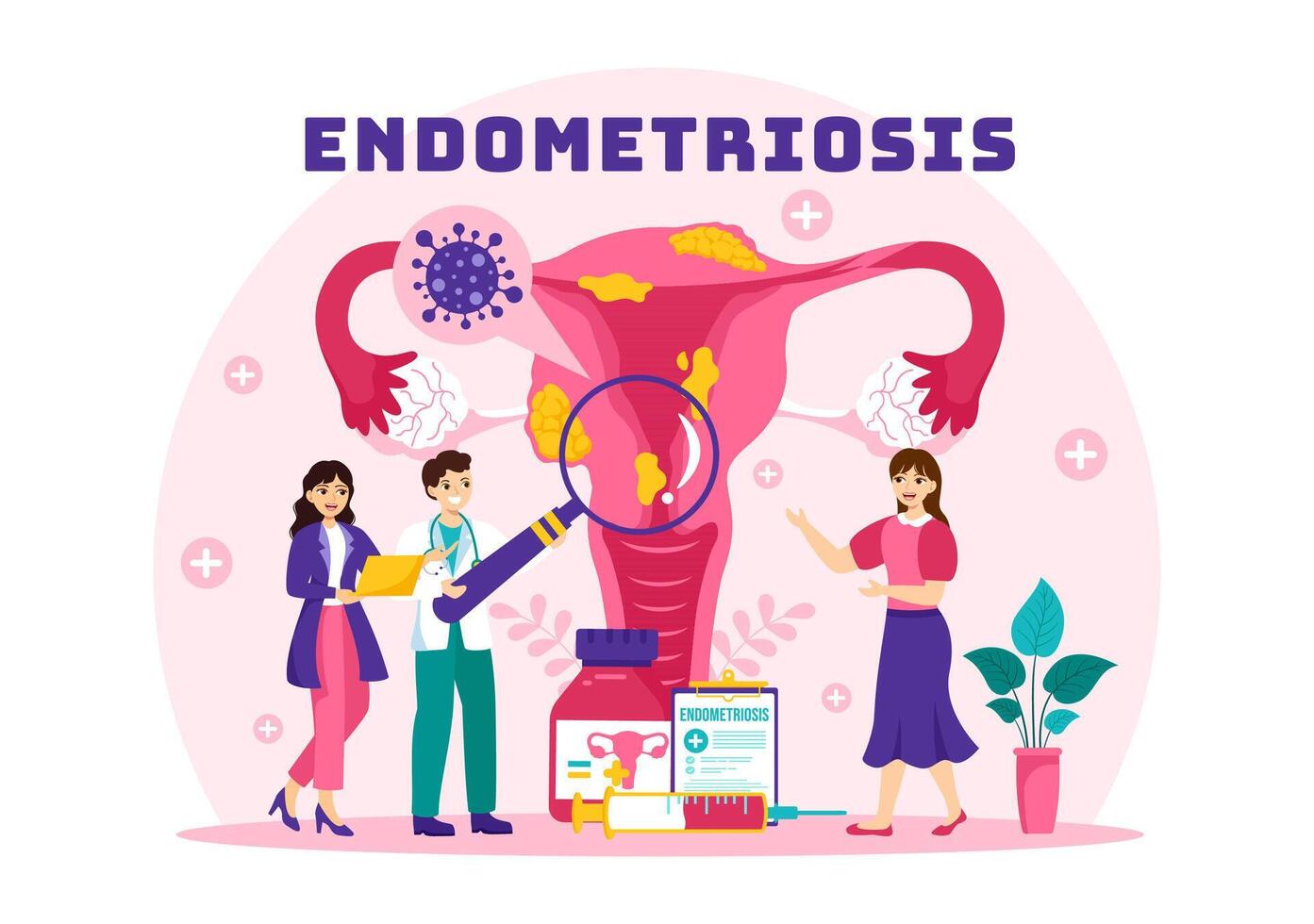 endometriosi vettore illustrazione con condizione il endometrio cresce al di fuori il uterino parete nel donne per trattamento nel piatto cartone animato sfondo