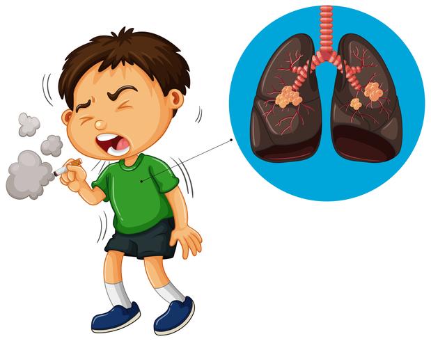 Ragazzo che fuma sigaretta e diagramma polmoni malsano vettore