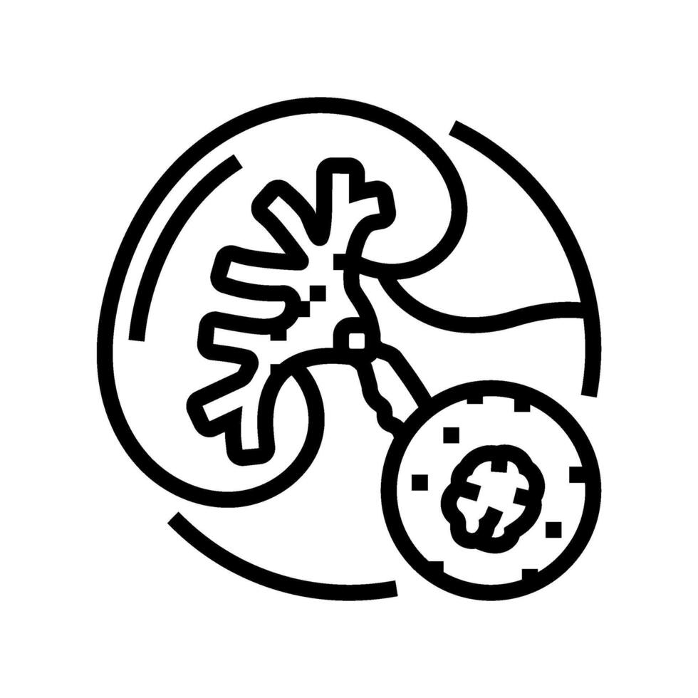 urolitiasi urologia linea icona vettore illustrazione