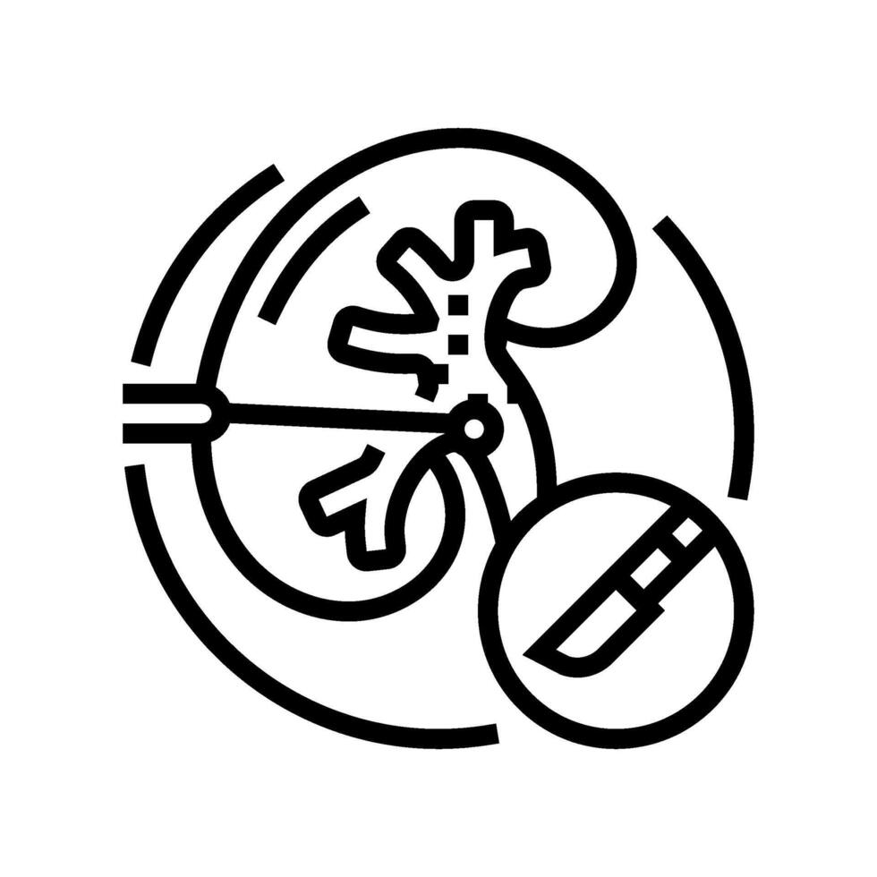 Percutaneo nefrolitotomia linea icona vettore illustrazione