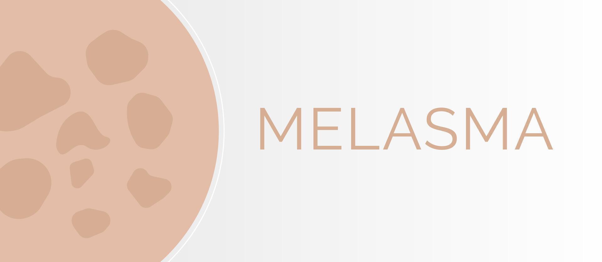 melasma pelle condizione illustrazione sfondo vettore