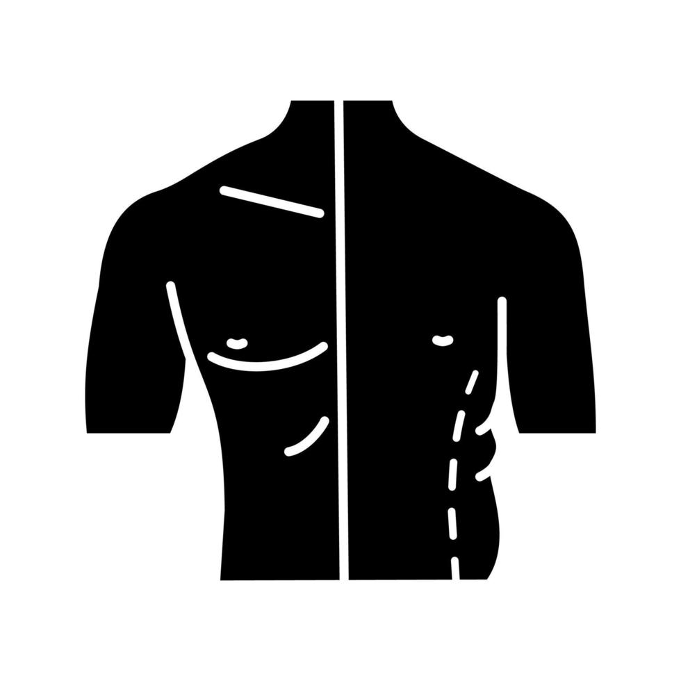 icona del glifo maschio coolsculpting. correzione fianchi. liposuzione maschile e rimodellamento del corpo prima e dopo. chirurgia plastica. simbolo di sagoma. spazio negativo. illustrazione vettoriale isolato