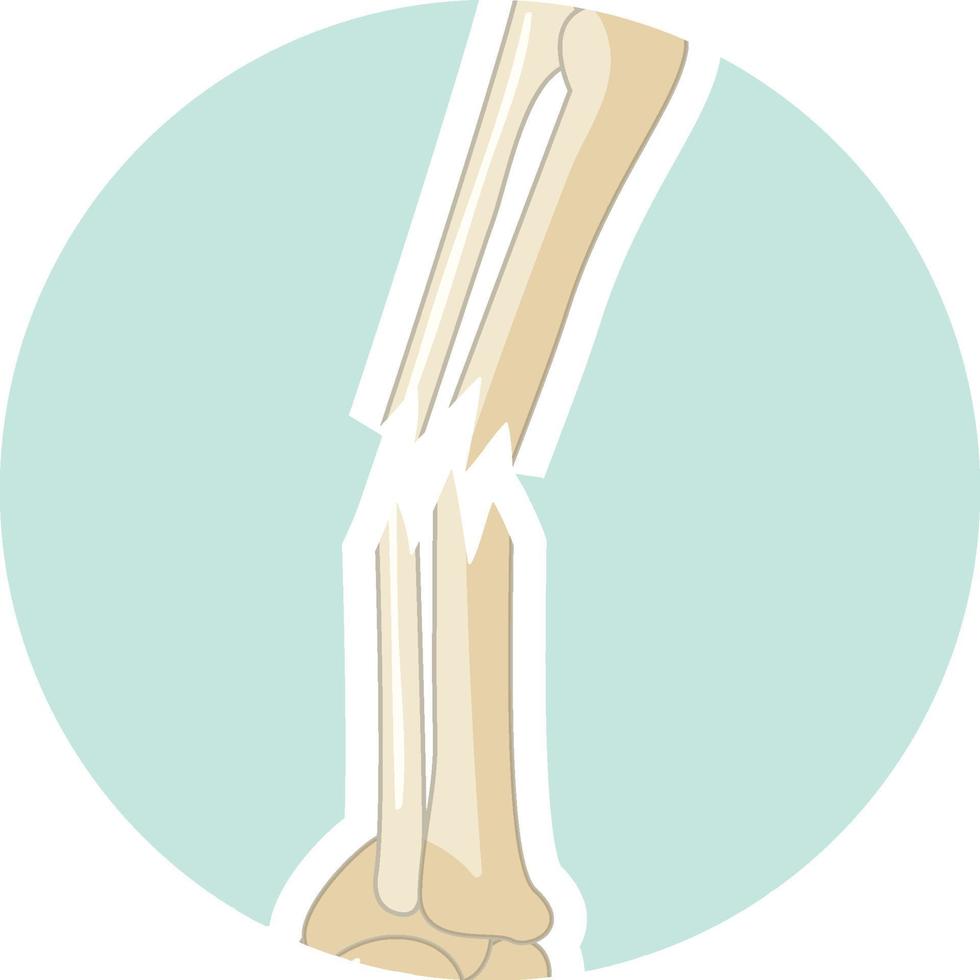 osso umano rotto in stile cartone animato vettore