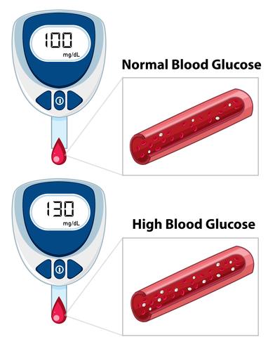 Misurazione della glicemia medica vettore