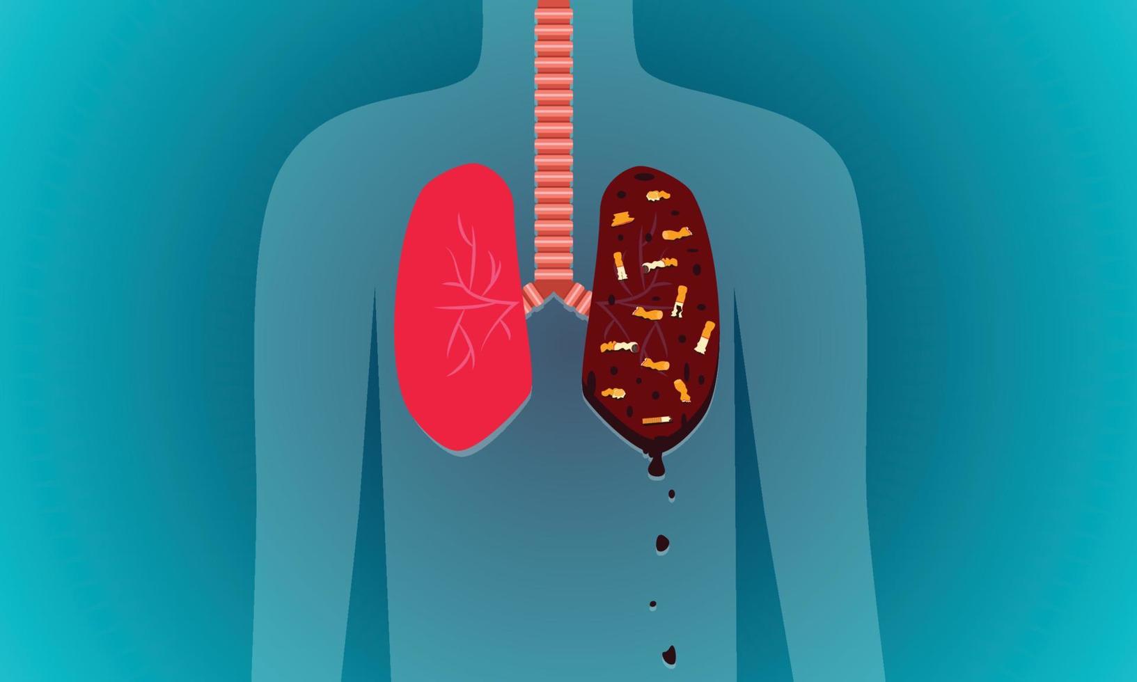 differenza polmone su ciascun lato. uno è fresco, forte e uno danneggiato dal fumo. illustrazione vettoriale eps10