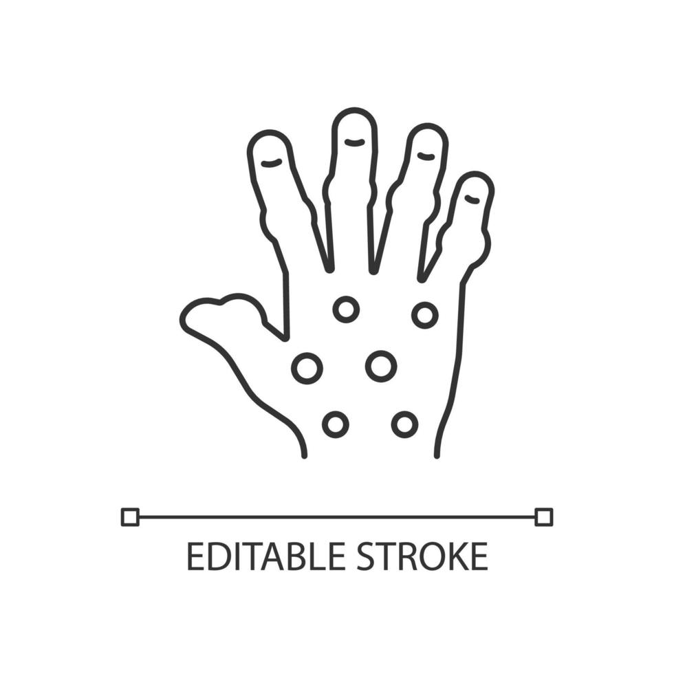 icona lineare dell'artrite psoriasica. articolazioni dolorose delle dita e delle mani. danni permanenti alle ossa. illustrazione personalizzabile a linea sottile. simbolo di contorno. disegno di contorno isolato vettoriale. tratto modificabile vettore