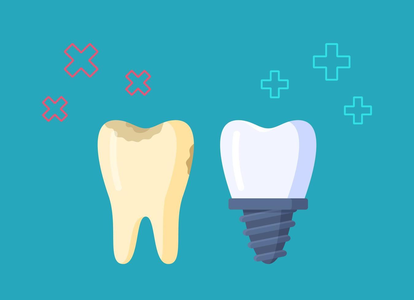 illustrazione vettoriale di cure odontoiatriche. un viaggio dal dentista. sostituzione del dente.