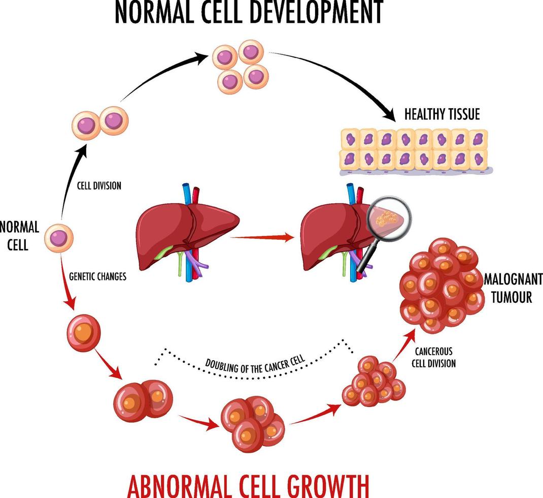 diagramma che mostra le cellule normali e cancerose nell'uomo vettore