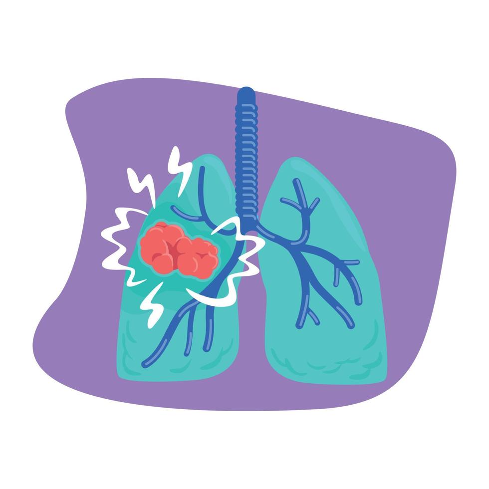 illustrazione isolata del vettore 2d del cancro del polmone