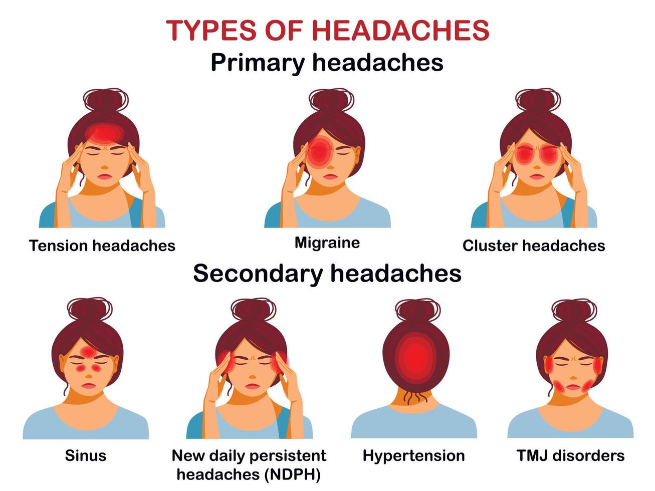 tipi di mal di testa. infografica vettoriale. vettore