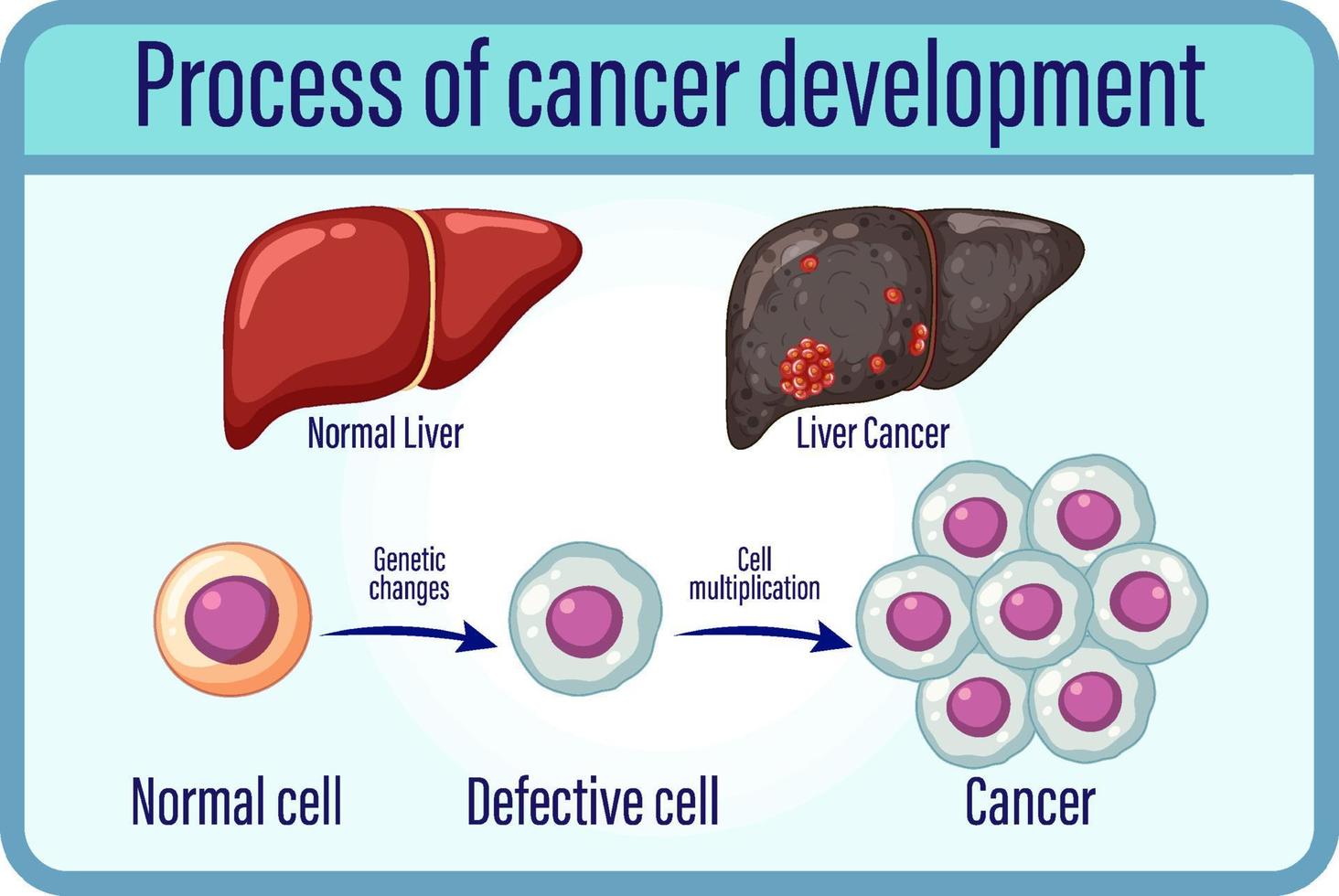 processo di sviluppo del cancro vettore