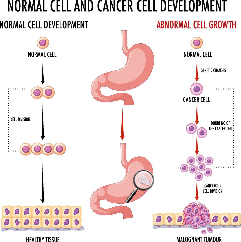 diagramma che mostra le cellule normali e cancerose nell'uomo vettore