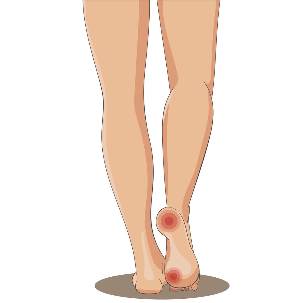 gambe femminili vista posteriore con segno di dolore vettore