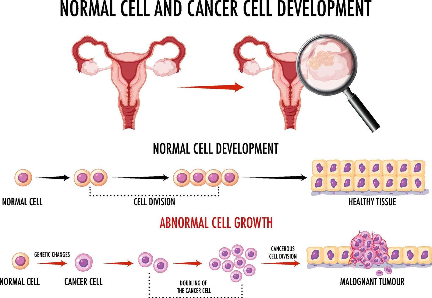 diagramma che mostra la cellula normale e quella cancerosa vettore