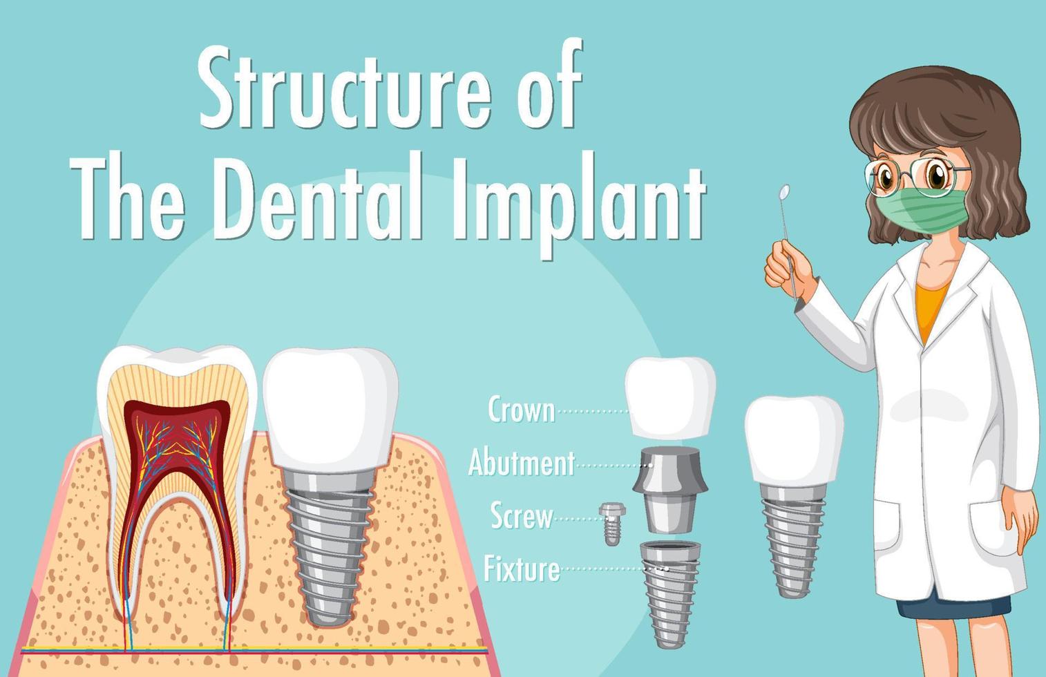 infografica dell'essere umano nella struttura dell'impianto dentale vettore