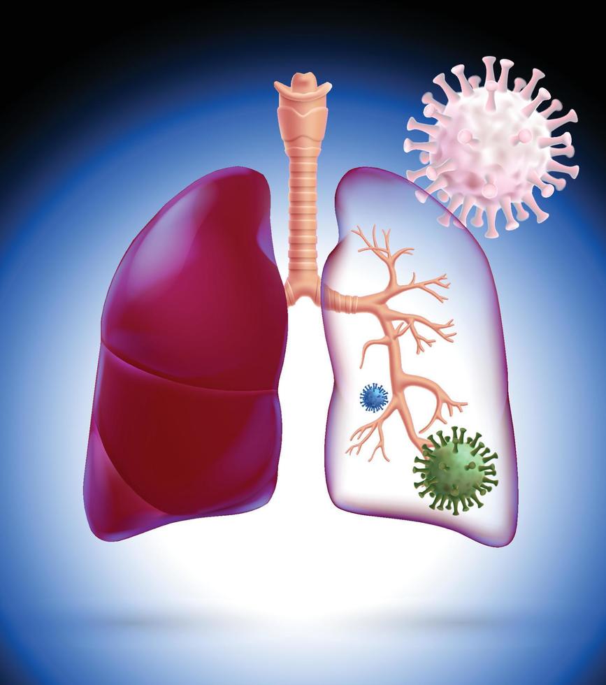 Illustrazione 3d di un polmone umano parzialmente traslucido per evidenziare i rami del sistema respiratorio all'interno dei polmoni contenenti cellule di coronavirus polmonari. vettore