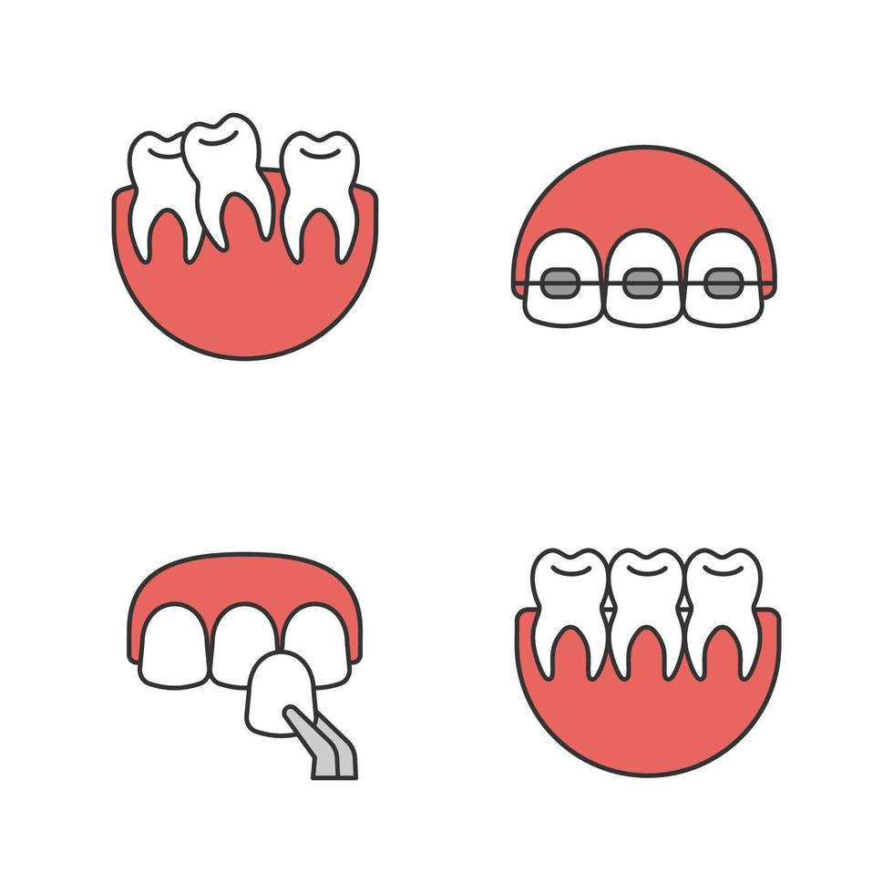 set di icone a colori per odontoiatria. stomatologia. denti storti e sani, apparecchi ortodontici, faccette. illustrazioni vettoriali isolate