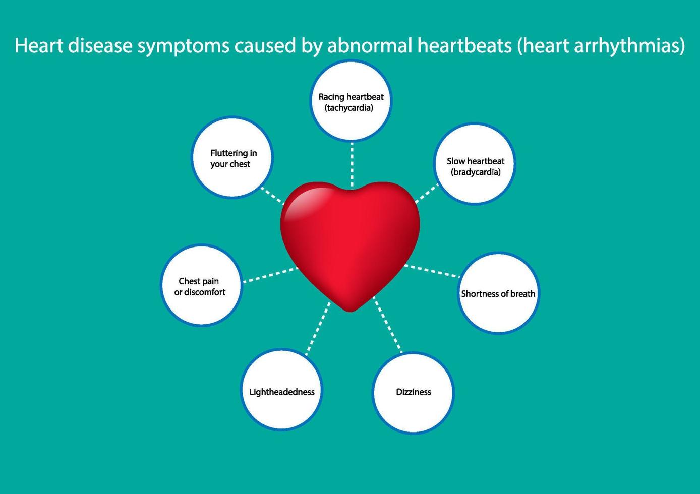 concetto di disegno grafico sintomi di malattie cardiache causati da battiti cardiaci anormali, illustrazione vettoriale
