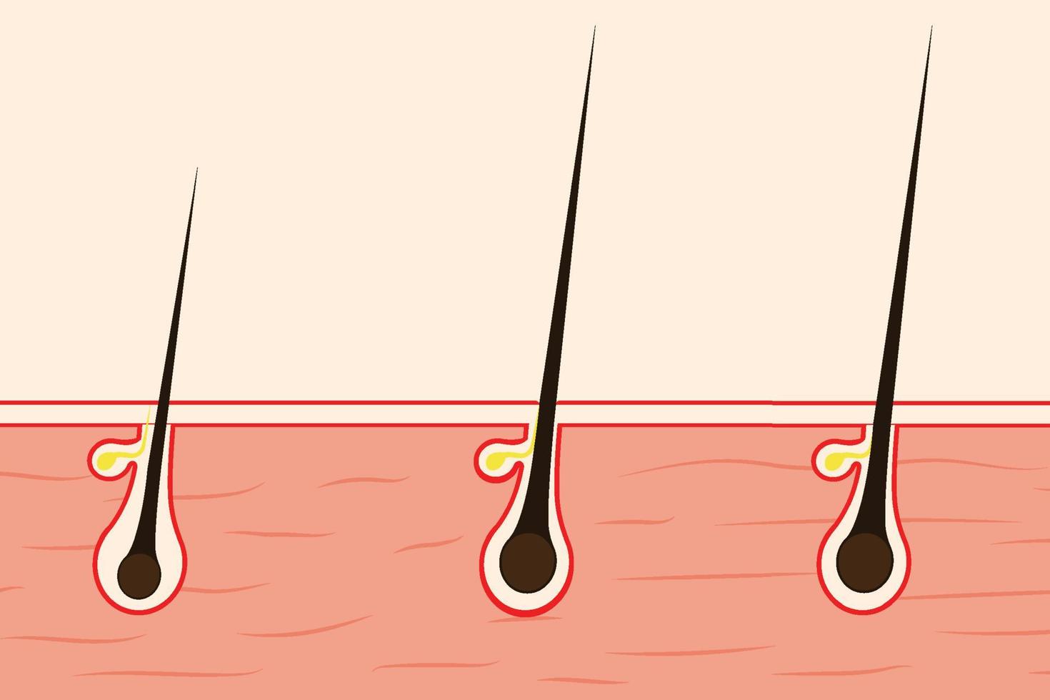 concetto di crescita dei capelli con un'illustrazione della pelle umana. follicoli piliferi con borse di olio e fili neri sulla pelle. fase di crescita anatomica dei capelli e fasi del vettore del ciclo di crescita dei capelli.