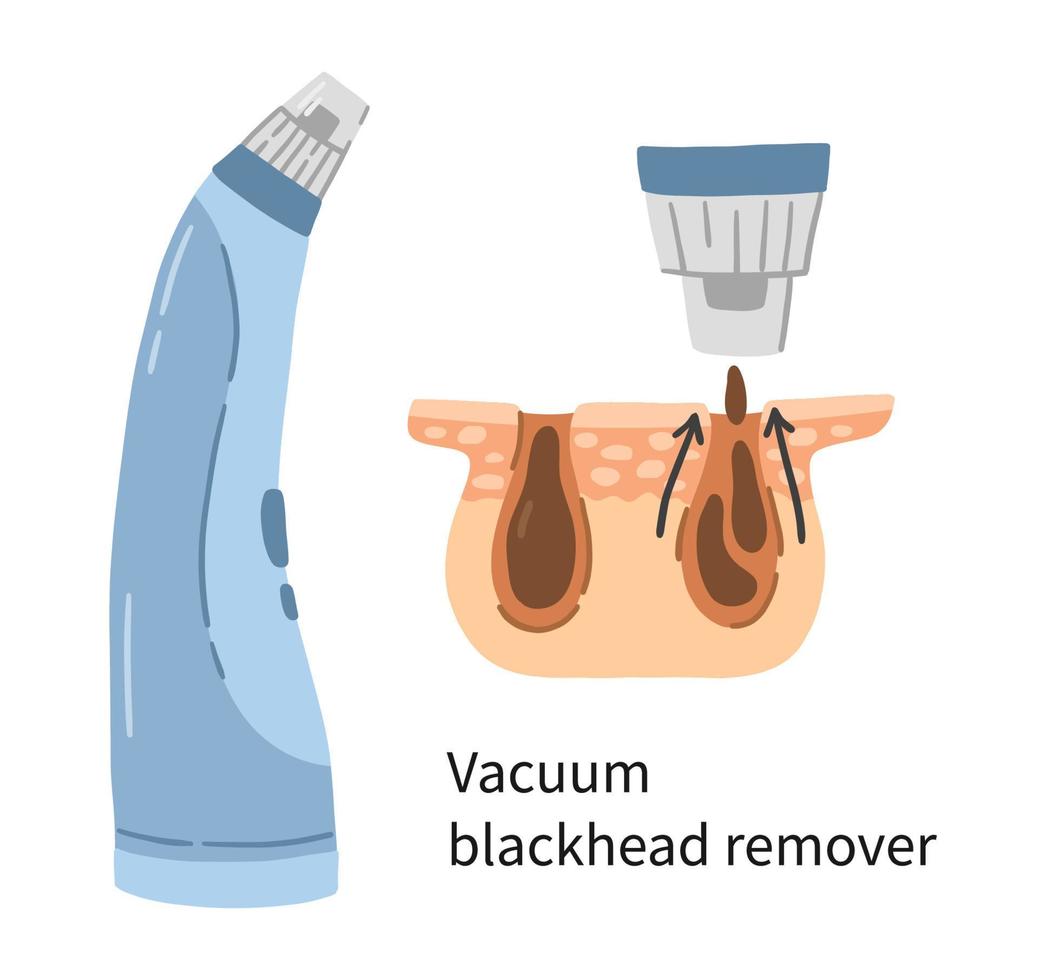 illustrazione vettoriale di rimozione di punti neri sottovuoto con strati di derma e pori. dispositivo facciale elettrico per la cura della pelle e il lavaggio in stile cartone animato doodle. rimozione di comedoni e cellule morte