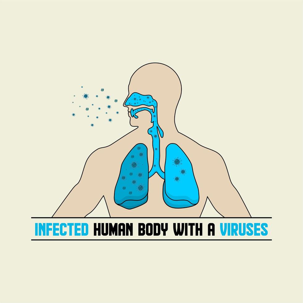 illustrazione infetta del tratto respiratorio umano vettore