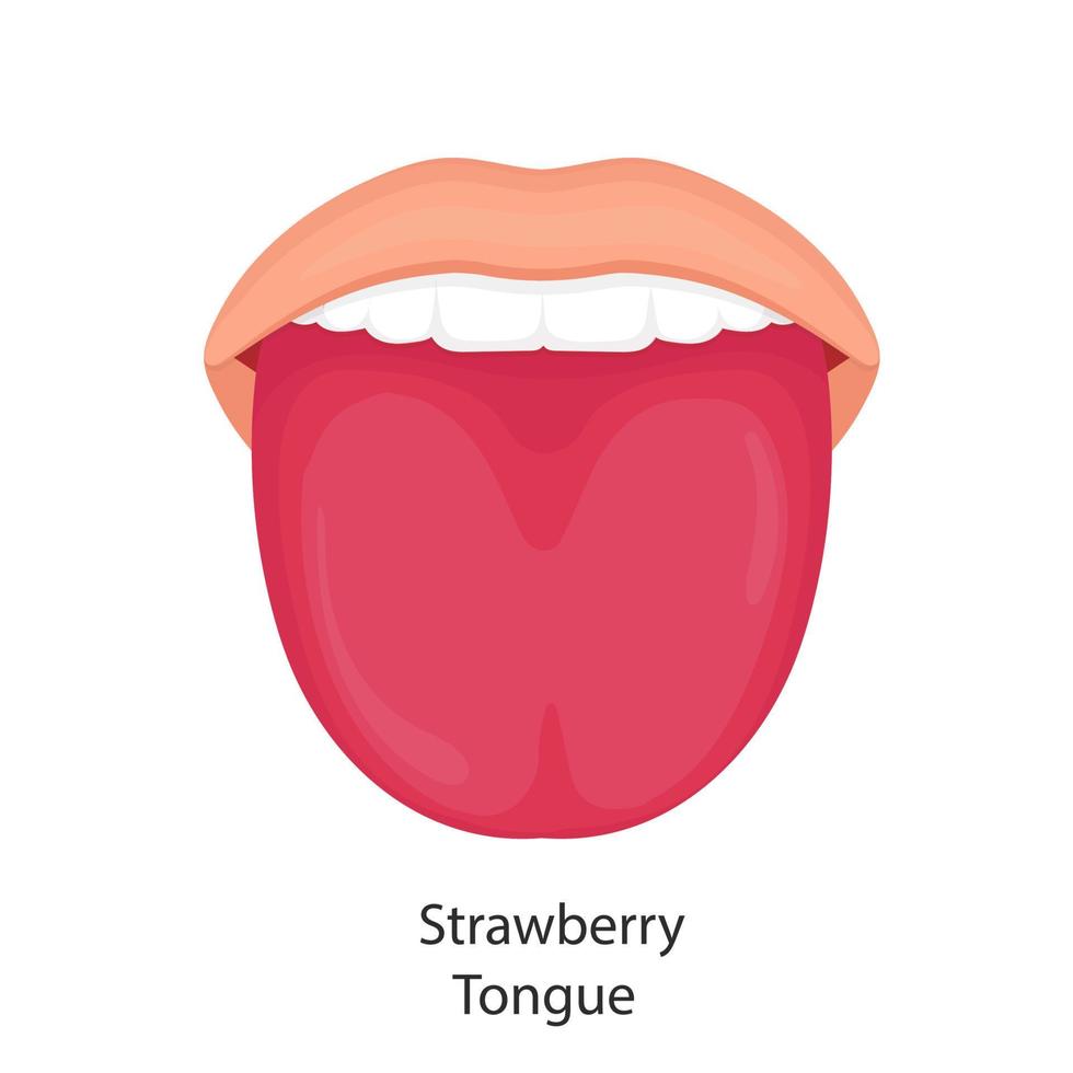 illustrazione vettoriale di lingua di fragola