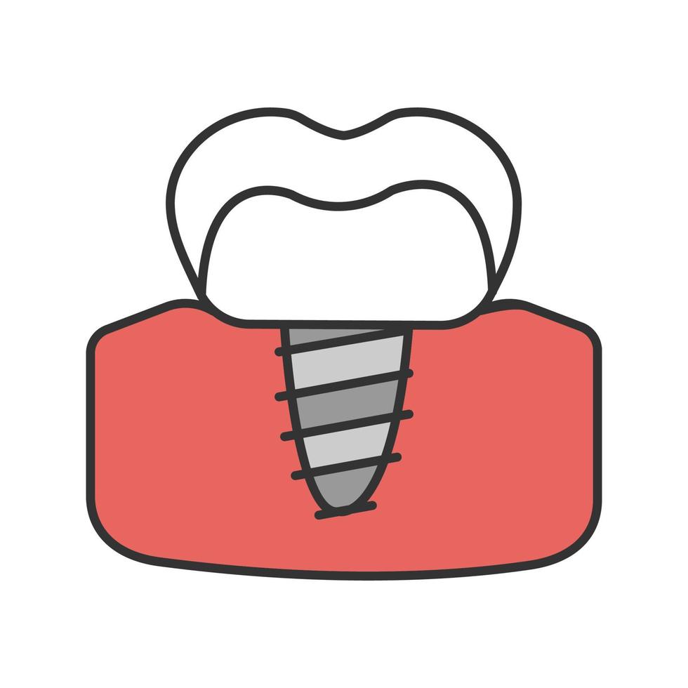 icona del colore dell'impianto dentale. impianto endosseo. illustrazione vettoriale isolata