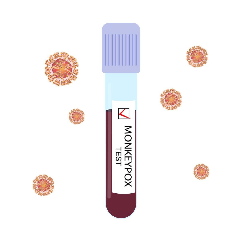 provetta, campione di sangue con test positivo per il virus del vaiolo delle scimmie e cellule virali isolate su sfondo bianco. illustrazione vettoriale. vettore