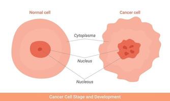 illustrazione dello stadio e dello sviluppo delle cellule tumorali vettore