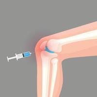 illustrazione di vettore di arrossamento dell'infiammazione dell'iniezione del ginocchio