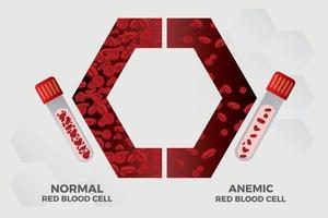 anemia ferro rosso sangue cellula medico vettore illustrazione medico.