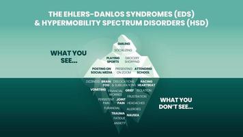 il iceberg modello di ehler Danlos sindromi eds e ipermobilità spettro disturbo hd concetto ha il superficie sintomo può vedere contento e normale comportamento per fisico analisi e diagnostico vettore