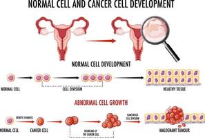 diagramma che mostra le cellule normali e cancerose vettore