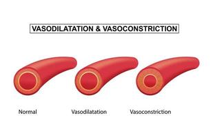 normale, vasodilatazione e vasocostrizione sangue nave, vettore illustrazione