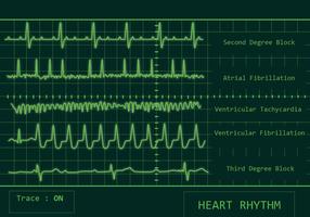 Pacchetto cardiaco di ritmo cardiaco vettore