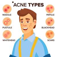 acne tipi vettore. uomo con acne. facciale pelle i problemi. papula, pustole scartoffie. isolato piatto cartone animato personaggio illustrazione vettore