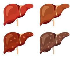 umano fegato impostare. stadi di fegato patologia. vettore illustrazione.