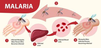 infografica di informazioni sui sintomi della malaria vettore